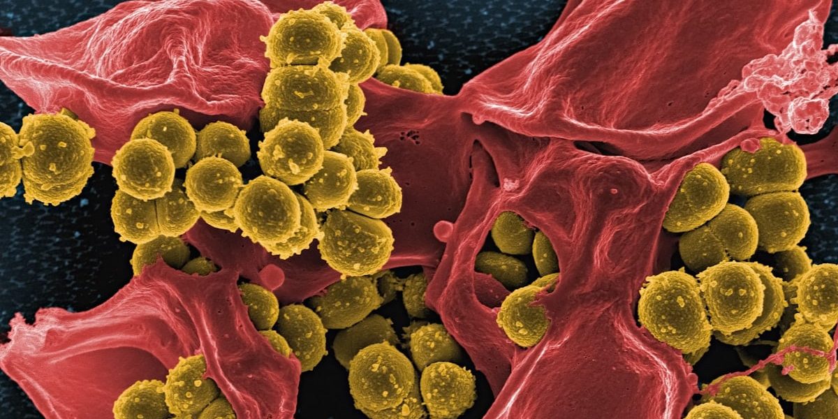 Methicillin-Resistant Staphylococcus aureus (MRSA) Bacteria Colorized scanning electron micrograph of methicillin-resistant Staphylococcus aureus (MRSA) bacteria (gold) interacting with a human neutrophil (red). Image captured at NIAID's Rocky Mountain Laboratories (RML) in Hamilton, Montana. Credit: NIAID https://www.flickr.com/photos/niaid/53362150191/